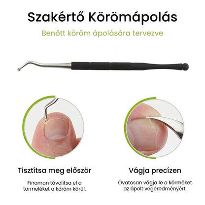 ✂️Precíziós benőtt körömvágó készlet